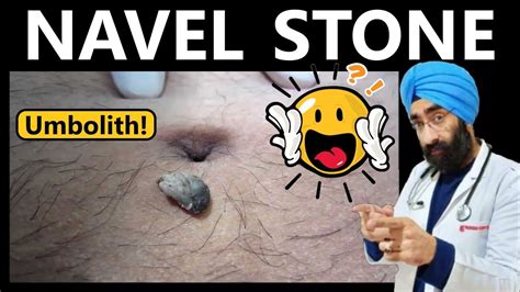 navel stone symptoms|Belly Button Stones: What Are They and What。